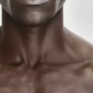 Fitzpatrick skin type VI