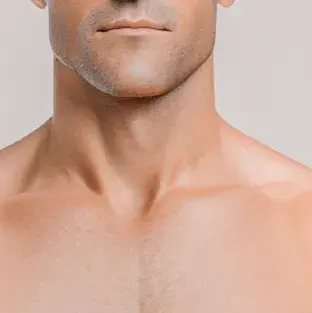 Fitzpatrick skin type III
