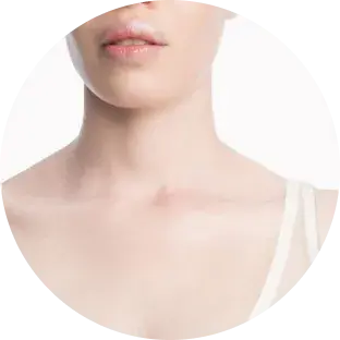 Fitzpatrick skin type I